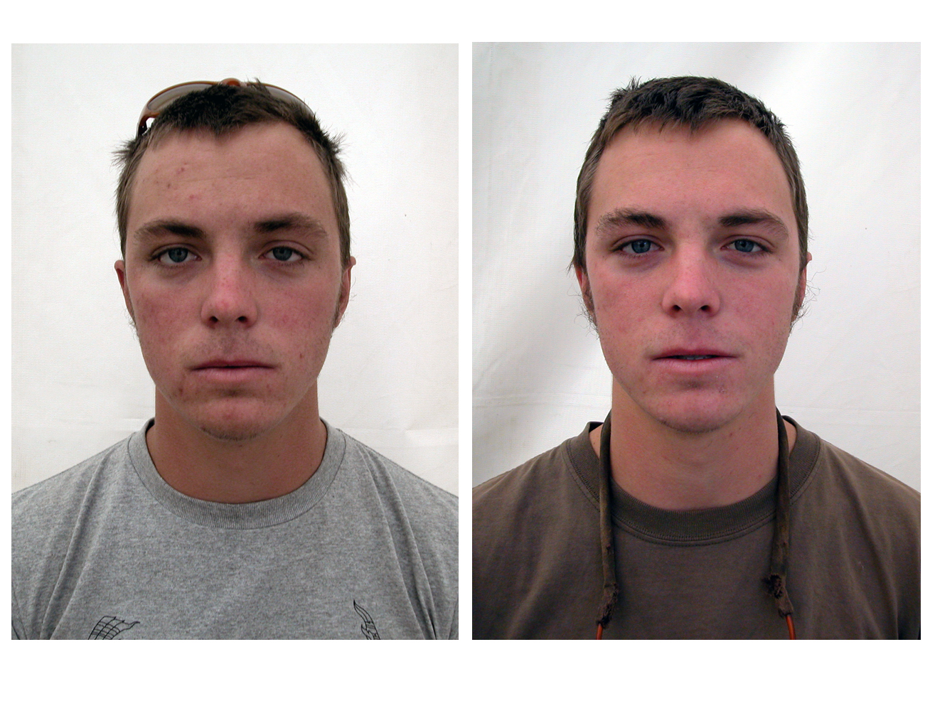 Какие изменения после 1 апреля. Внешность людей до и после. Изменение внешности до и после. Исправление внешности. Изменение внешности мужчины.