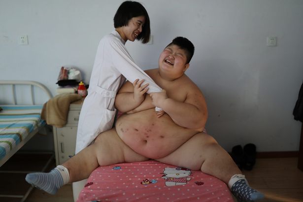 pay-china-obesity-problem-rising-in-children-2