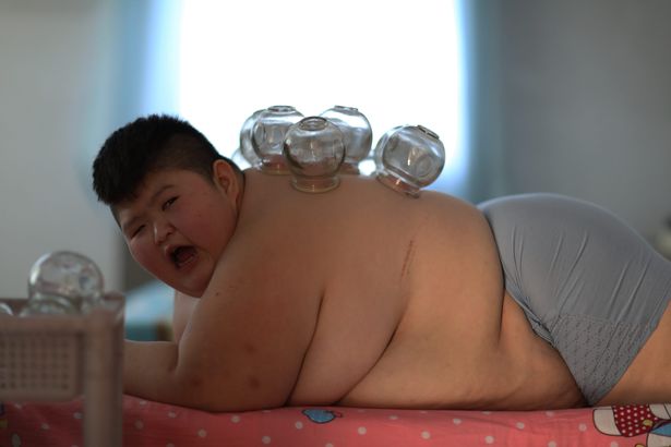 pay-china-obesity-problem-rising-in-children-4
