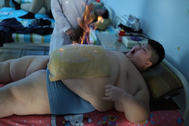 pay-china-obesity-problem-rising-in-children