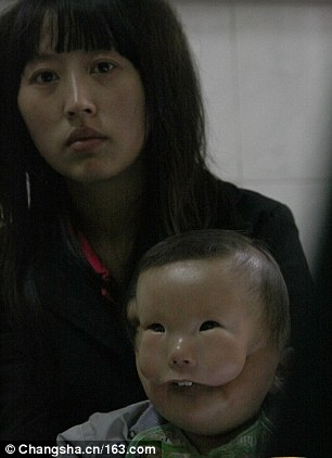 3C12451000000578-0-Huikang_s_mother_left_said_she_was_devastated_when_she_saw_her_b-a-33_1484220357946