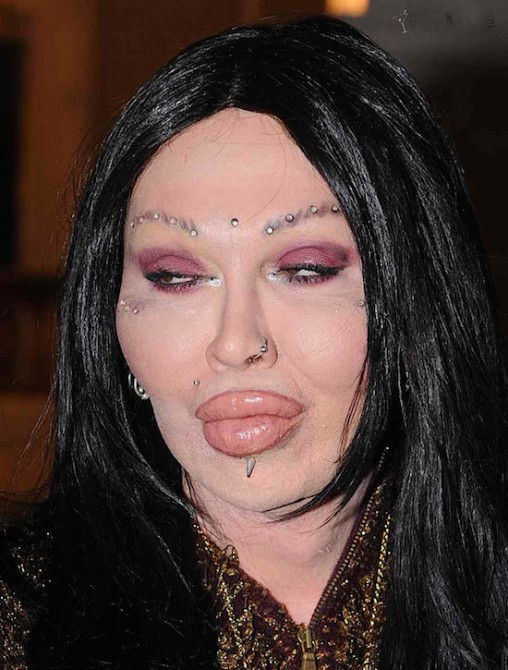 plastic-surgery-gone-wrong-5-508x670