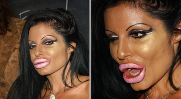 plastic-surgery-gone-wrong-featured-620x339