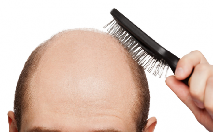 Matu maska pret matu izkrišanu – dabīgi un efektīvi