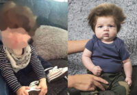 Kā tagad izskatās slavenais mazulis, kurš piedzima ar apjomīgiem matiem