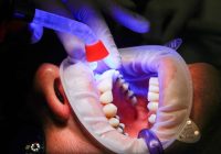 Katrs zobs ir saistīts ar kādu ķermeņa orgānu: sāpes jebkurā no tiem var prognozēt problēmas nākotnē