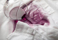 Kā 5 minūtēs noņemt jebkuru traipu: padomi no pagātnes, no kuriem mūsdienu ķīmiķi izvairās Kā 5 minūtēs noņemt jebkuru traipu: padomi no pagātnes, no kuriem mūsdienu ķīmiķi izvairās