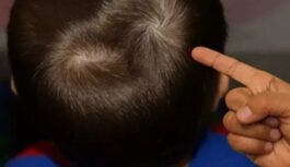 Divi matu virpuļi uz galvas: ko šī retā detaļa var atklāt par jūsu raksturu un likteni Divi matu virpuļi uz galvas: ko šī retā detaļa var atklāt par jūsu raksturu un likteni