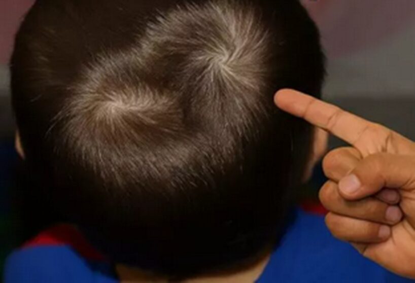 Divi matu virpuļi uz galvas: ko šī retā detaļa var atklāt par jūsu raksturu un likteni