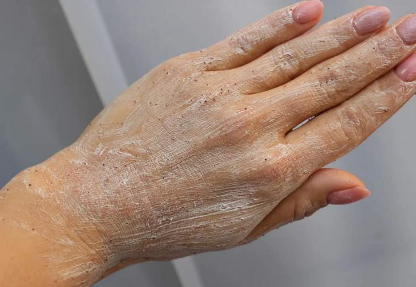 Draudzenei jau teju 50, bet roku āda kā jaunai meitenei. Tagad arī lietoju viņas ieteikto līdzekli, un tas nav dārgs krēms