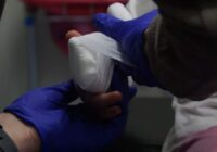 Jēkabpils reģionālā slimnīca jau ilgstoši nevar atrast traumatologu, lai ari tiek solīta liela alga – tiek nosaukti cipari